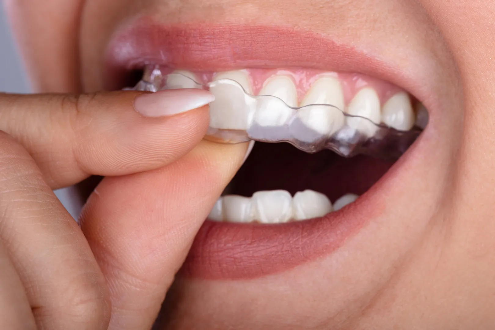 Cosmetic Dentistry