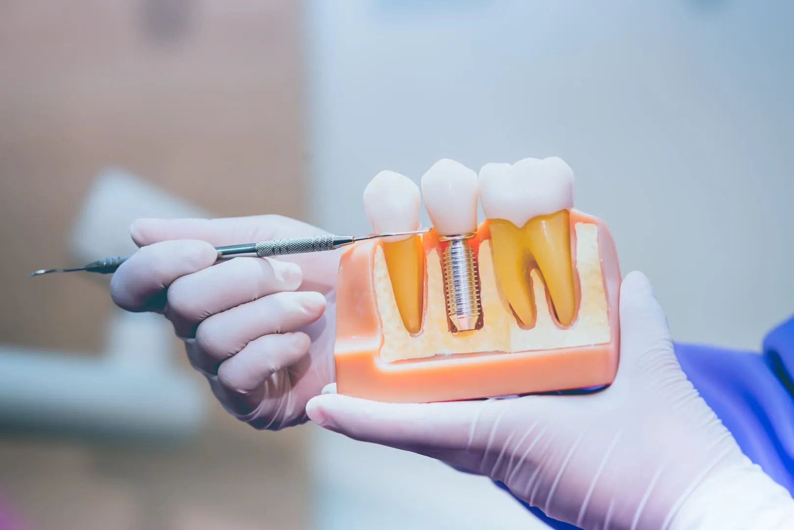 Restorative Dentistry